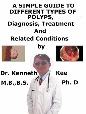 cover image of A Simple Guide to Different Types of Polyps, Diagnosis, Treatment and Related Conditions